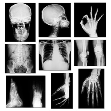 X ray Near yelahanka